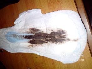 01月经的正常颜色应该为暗红色,正常在3到7天之内都是正常的,如果低于