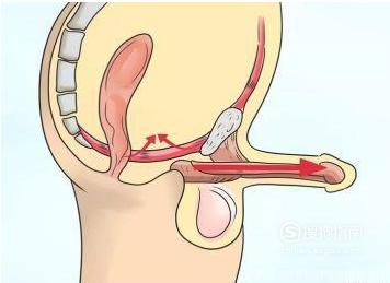 如何正确锻炼pc肌