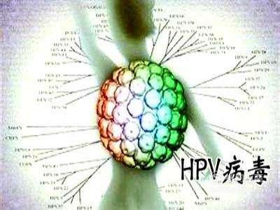 hpv病毒的专业检查方法是什么