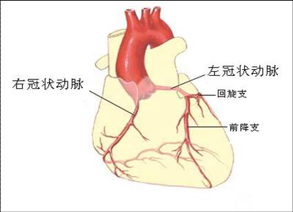 心肌缺血的治疗方法