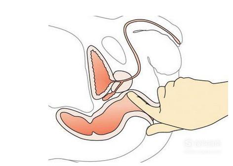 前列腺按摩的技巧