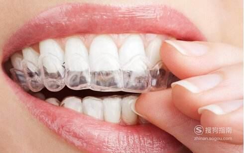 牙齿矫正后保持器要戴多久