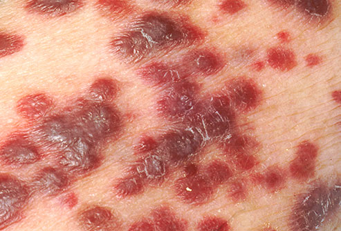 艾滋病病毒相关知识介绍