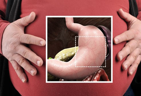 手术减肥方法有哪些？减肥手术后会发生哪些变化？