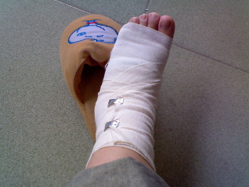 01一般来讲,如果自己活动时扭伤部位虽然疼痛,但并不剧烈,大多是软