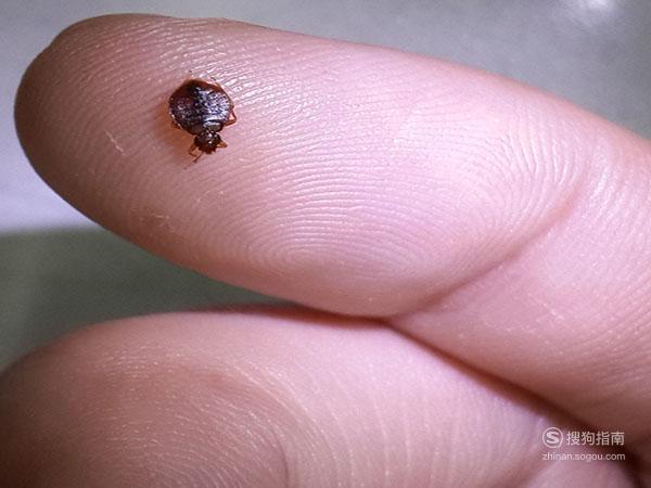 床虱叮咬的治疗