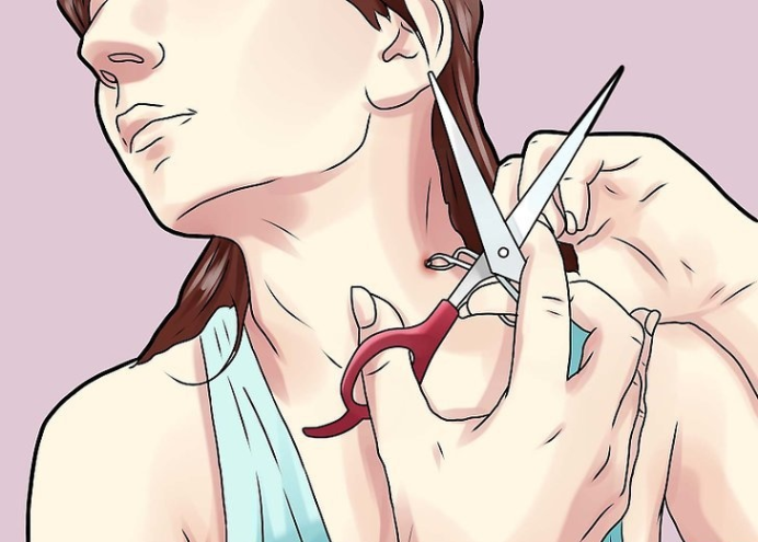 如何去除你脖子上的皮垂