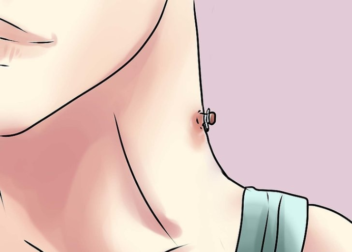 如何去除你脖子上的皮垂