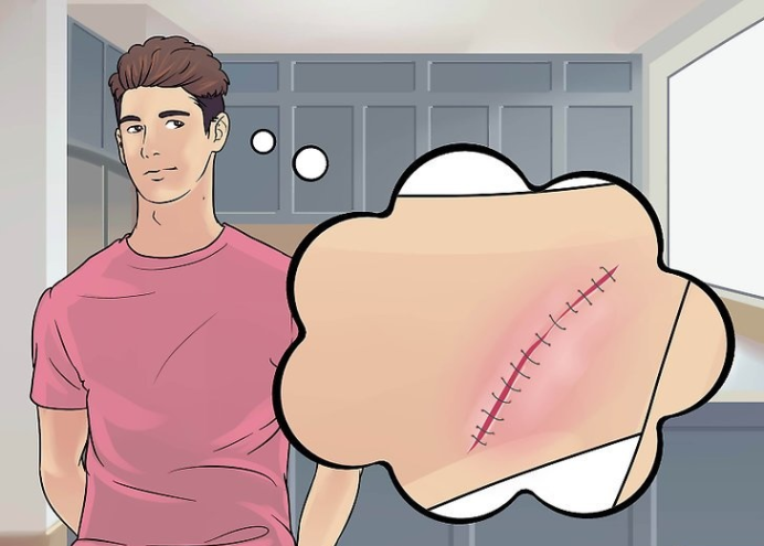 安全地清洗手术伤口