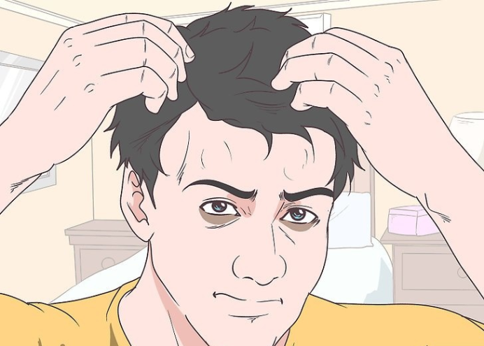如何治疗头发稀疏