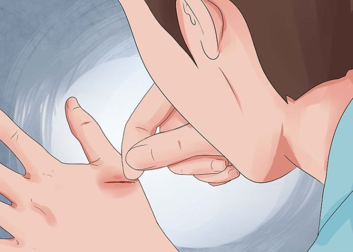 如何检查伤口是否感染